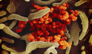 Nueva prueba de coronavirus abre puerta a aplicación en masa