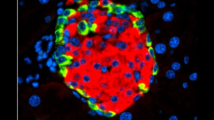Identifican el mecanismo que explica cómo un virus puede causar diabetes Identifican el mecanismo que explica cómo un virus puede causar diabetes