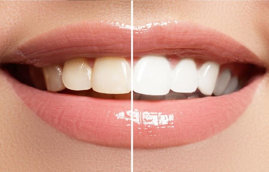Los productos para blanquear los dientes pueden dañar su colágeno y proteínas