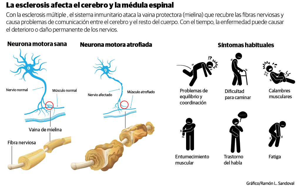 Infografía
