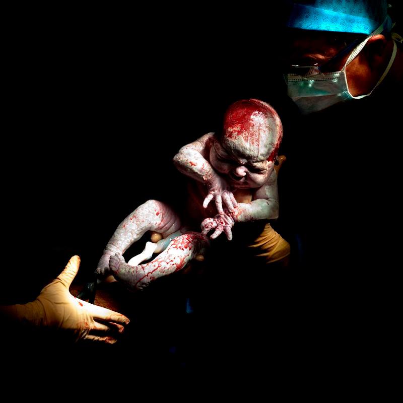 CESAR # 4 - Louann. Nació el 12 de abril de 2013 a las 8:40 a.m. 3,6 kg, 14 segundos de vida. 