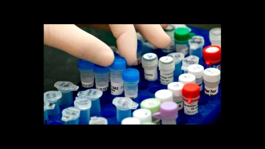 Hallan que medicinas para VIH y sida pueden combatir problemas neurológicos