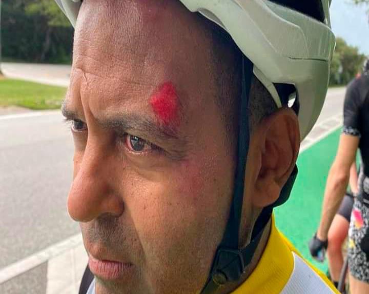 Tony Dandrades sufre accidente en bicicleta