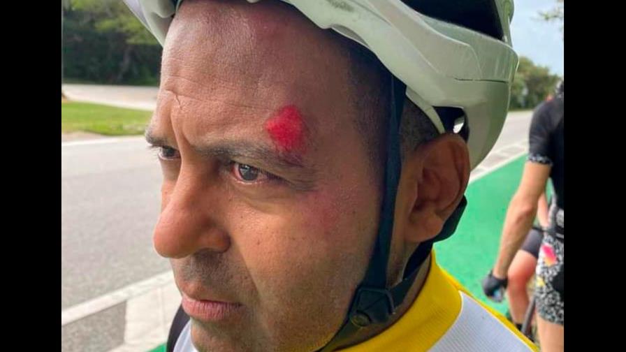 Tony Dandrades sufre accidente en bicicleta