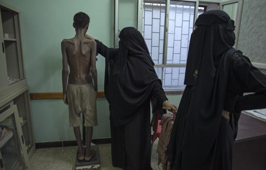 Los migrantes sufren violaciones y torturas en Yemen