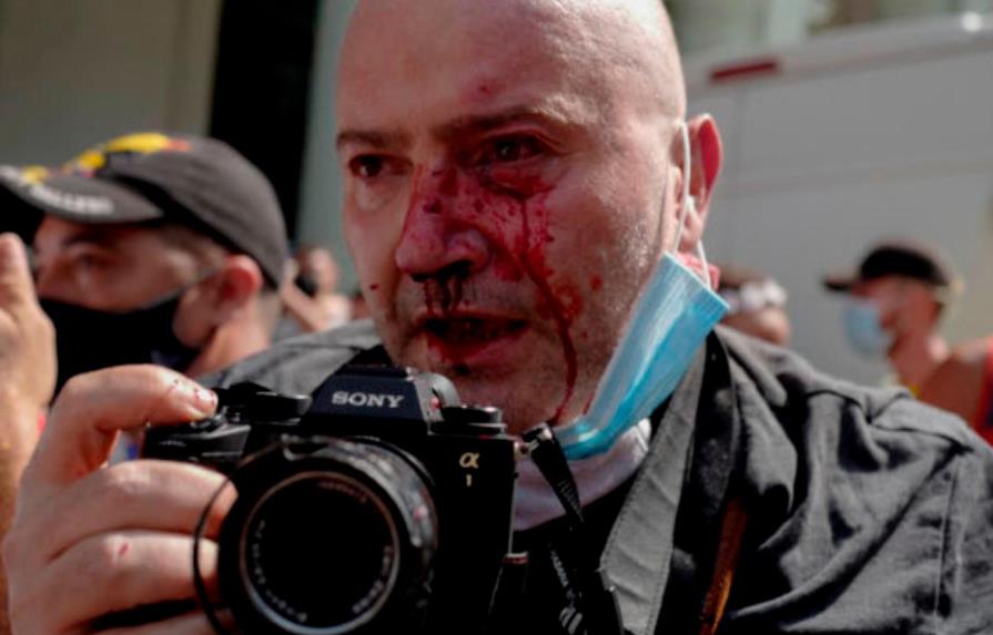 Un fotógrafo de AP resulta herido en protesta en Cuba