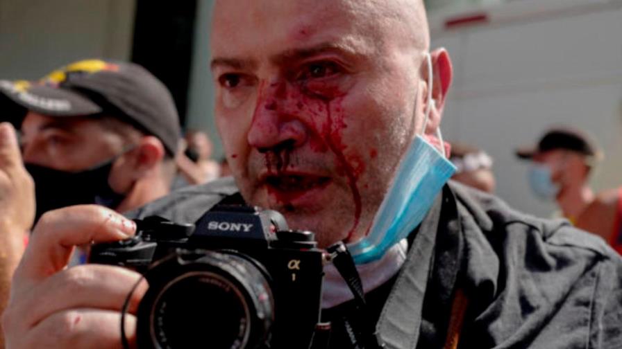 Un fotógrafo de AP resulta herido en protesta en Cuba