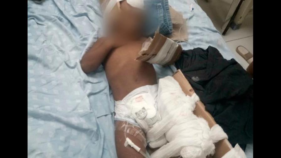 En el hospital Jaime Mota usan cartón por falta de yeso En el hospital Jaime Mota usan cartón por falta de yeso