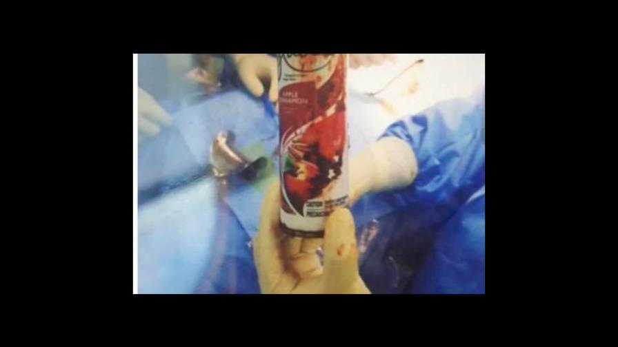 Hospital determina no hubo falta de ética en caso de hombre con objeto en el recto Hospital determina no hubo falta de ética en caso de hombre con objeto en el recto