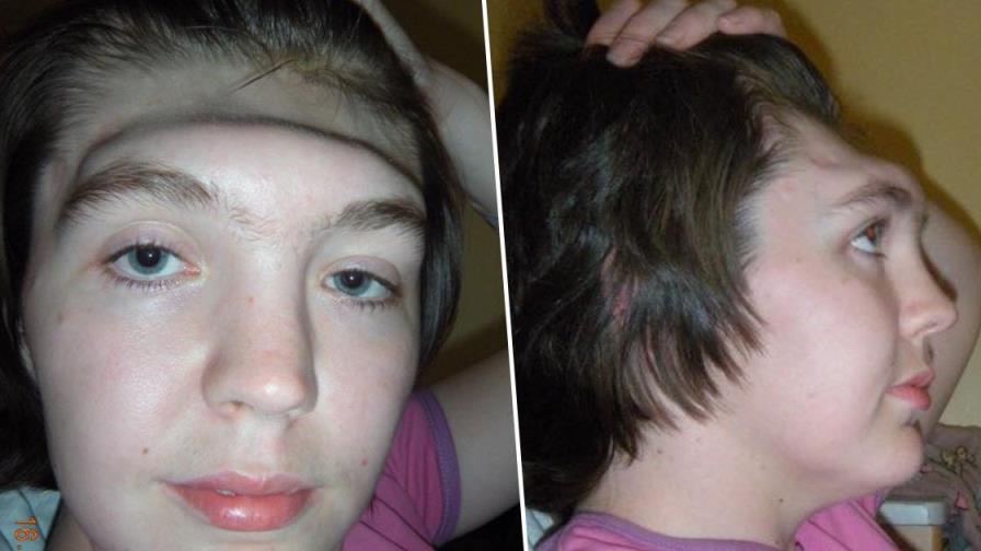 Mujer cuenta la historia de cómo quedó sin la frente de su cara