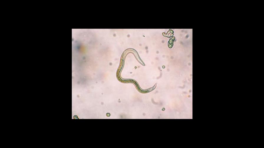 Usan gusanos para identificar puntos débiles de células tumorales humanas