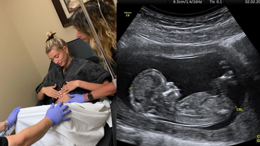 Las bromas con las que varios famosos enojaron a sus fans 