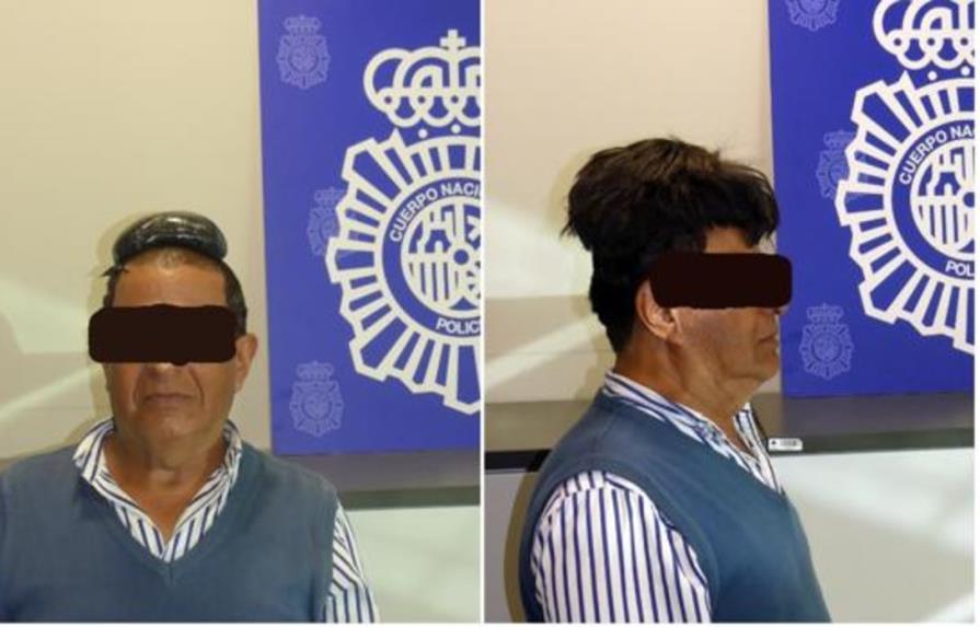 Detienen hombre que ocultaba medio kilo de cocaína debajo de su peluquín 