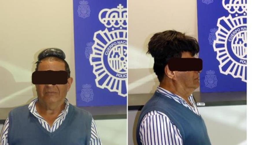Detienen hombre que ocultaba medio kilo de cocaína debajo de su peluquín 