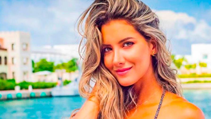 Le amputarán un pie a ex Miss Colombia 