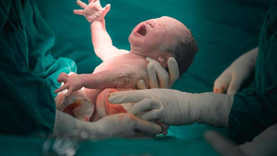 Hospital de la Mujer proyecta reducir número de cesáreas 