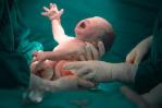 El 90 por ciento de los partos en  los centros privados son cesáreas