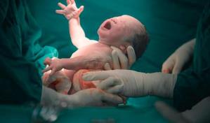 El 90 por ciento de los partos en  los centros privados son cesáreas