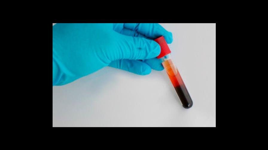 Ministerio de Salud llama a ciudadanos a conocer su tipo de sangre Ministerio de Salud llama a ciudadanos a conocer su tipo de sangre
