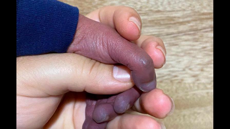 El niño Noah necesita ayuda económica para tratar cardiopatía congénita