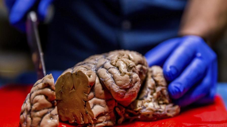 La menor energía neuronal hace al cerebro más proclive a enfermar con la edad