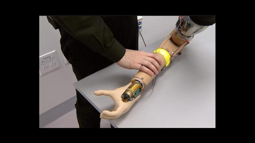Desarrollan técnica quirúrgica que mejora sensación y control de las prótesis 