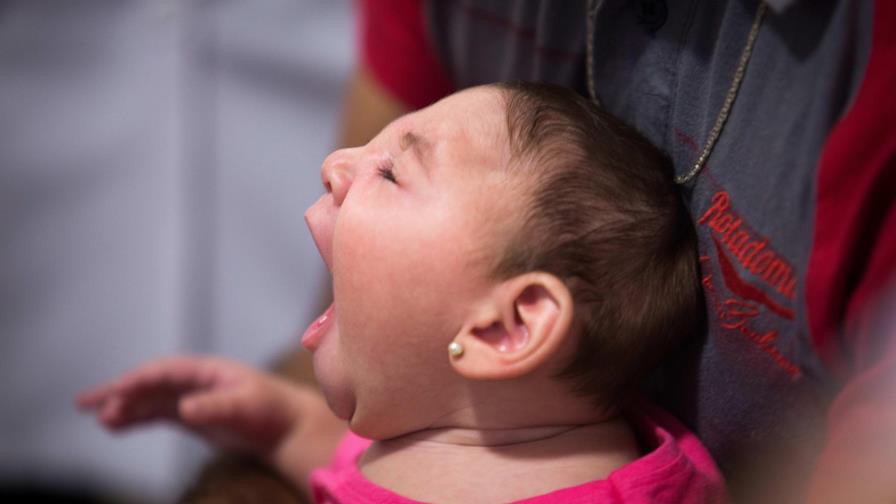 Científicos prevén que bebés con zika tendrán déficits cognitivos al crecer