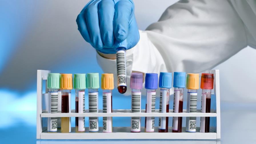 Investigadores avanzan en la búsqueda de una vacuna contra la sífilis 