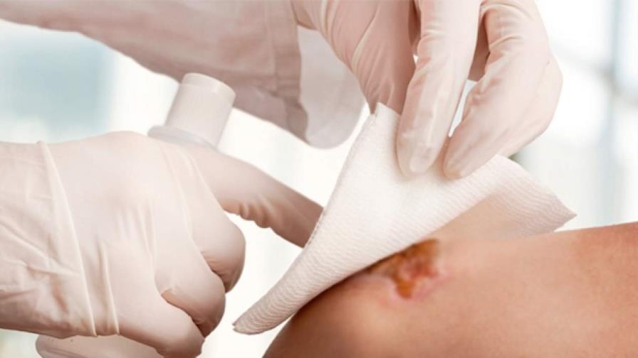 Desarrollan hidrogel capaz de liberar medicamentos para cicatrizar heridas 