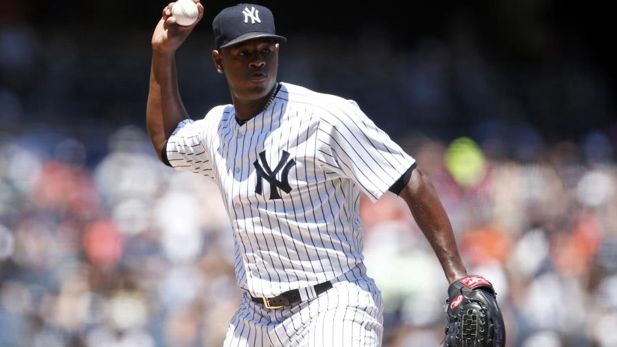 ¿Severino igualará los 15 JG Ubaldo? ¿Severino igualará los 15 JG Ubaldo?