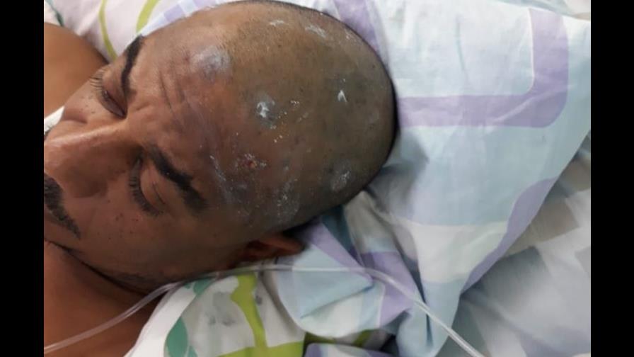 Denuncian que presos en Valverde contraen gusanos en la piel por bacteria