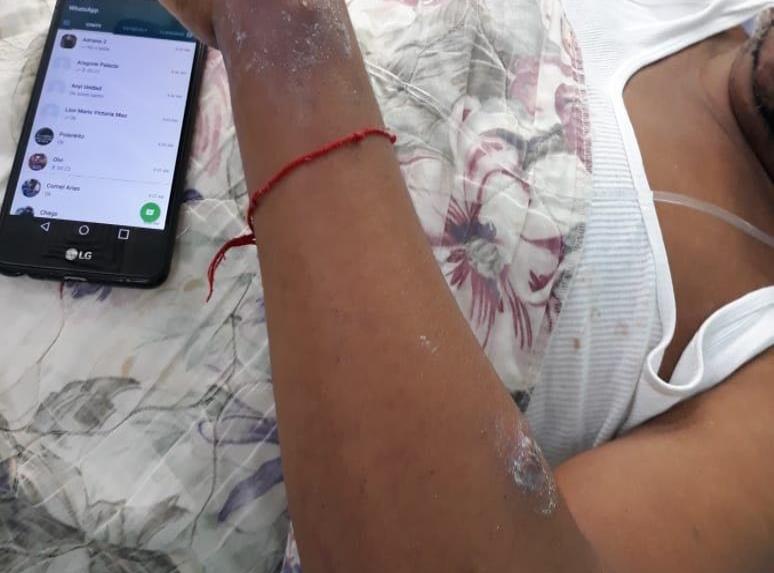 Médicos atienen presos en Valverde que contrajeron gusanos en la piel por bacteria