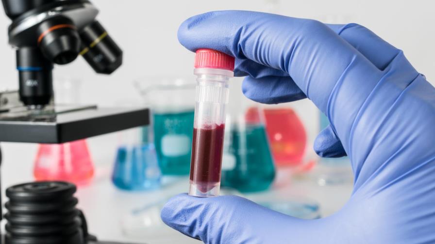 Nuevo análisis de sangre puede predecir riesgo de cáncer de pulmón