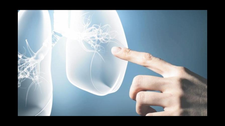 Tratamiento innovador eleva supervivencia de pacientes con cáncer metastásico