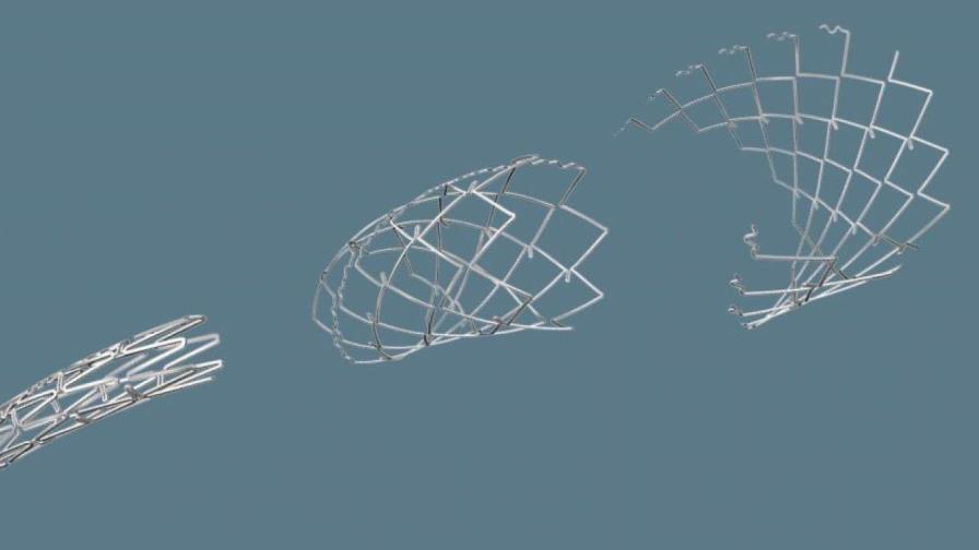 Hospital de Zúrich implanta a un bebé un estent con potencial de crecimiento