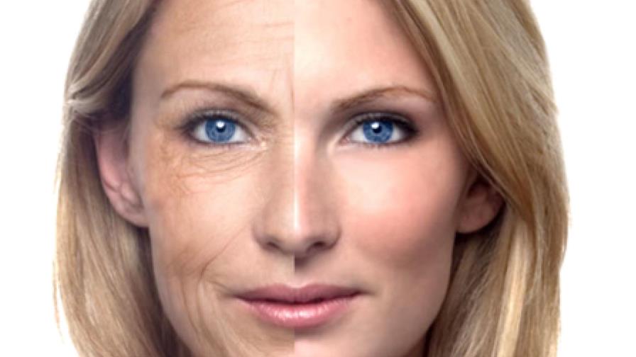 Fotoenvejecimiento, factor de riesgo para el desarrollo de cáncer de piel