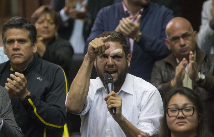 Diputados opositores serán enjuiciados por “atentado” contra Maduro