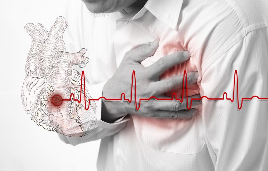 ¿Luego de un infarto cardiaco, qué cuidados debo tener?