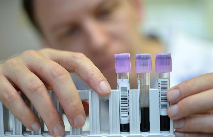 Un test sanguíneo permite conocer reloj interno de pacientes en hora y media