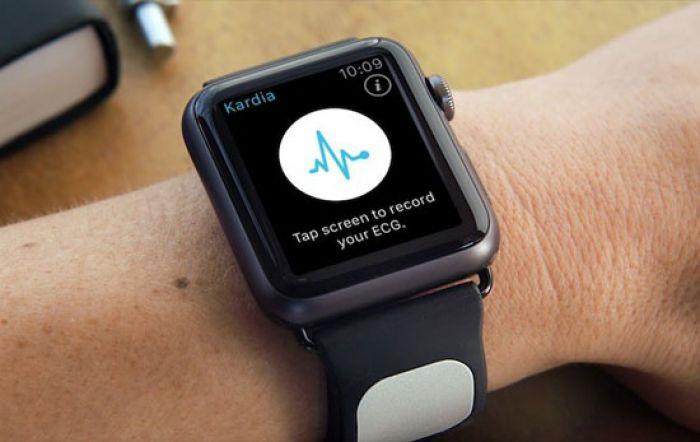 El nuevo reloj de Apple puede realizar un electrocardiograma en 30 segundos