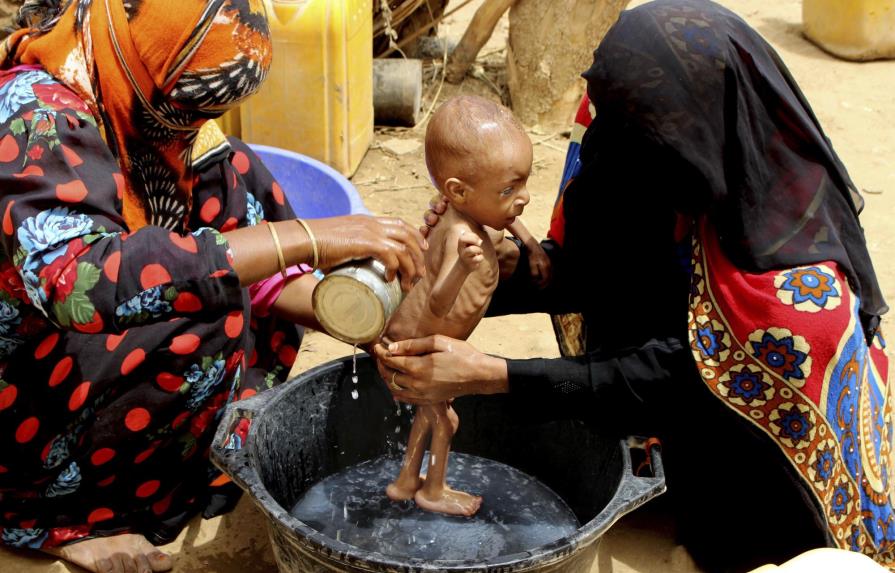 La hambruna acecha a Yemen tras años de guerra