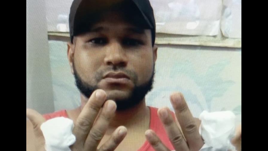 Narcos cortan con un machete dedos de las manos de un joven Narcos cortan con un machete dedos de las manos de un joven