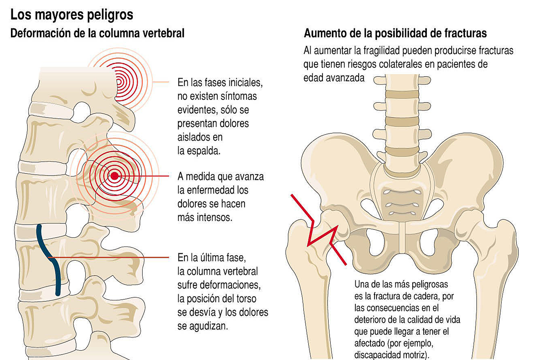 Infografía