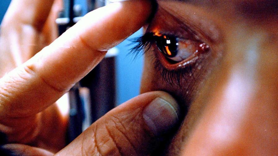 Los ojos, una ventana para detectar enfermedades 
