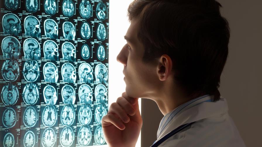 Hoy es Día Mundial  del Ataque Cerebral