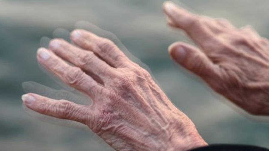 Descubren que eliminar apéndice reduce riesgo de tener párkinson hasta un 25% Descubren que eliminar apéndice reduce riesgo de tener párkinson hasta un 25%