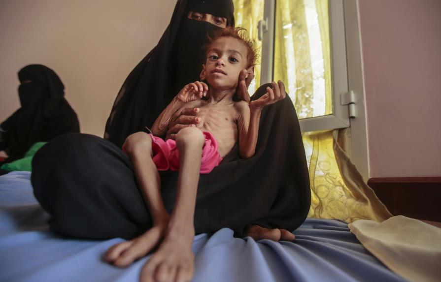 Unicef: “la guerra del Yemen se ha convertido en una guerra contra los niños”
