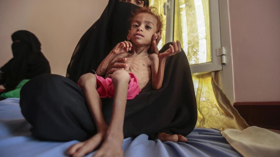Unicef: “la guerra del Yemen se ha convertido en una guerra contra los niños”