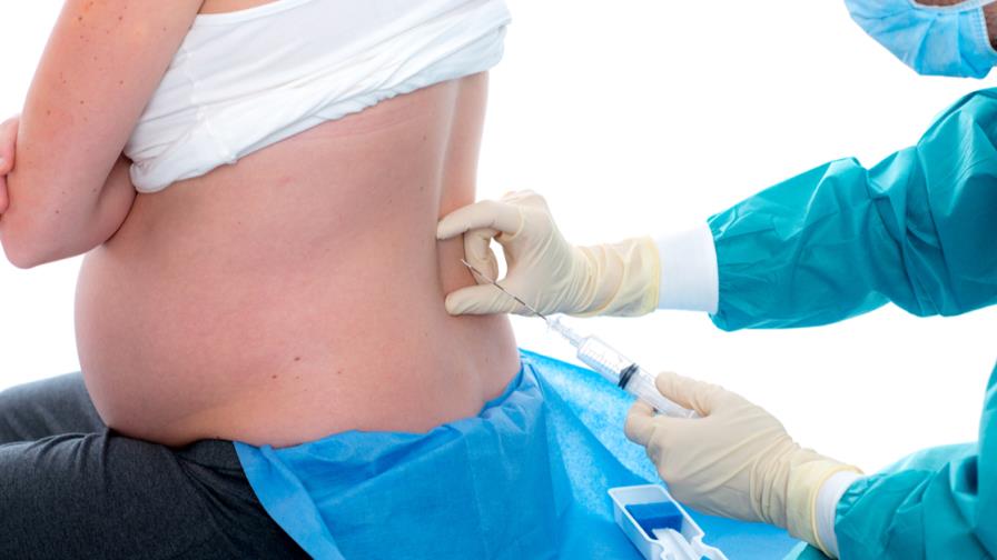 La anestesia epidural no prolonga la segunda fase del parto 