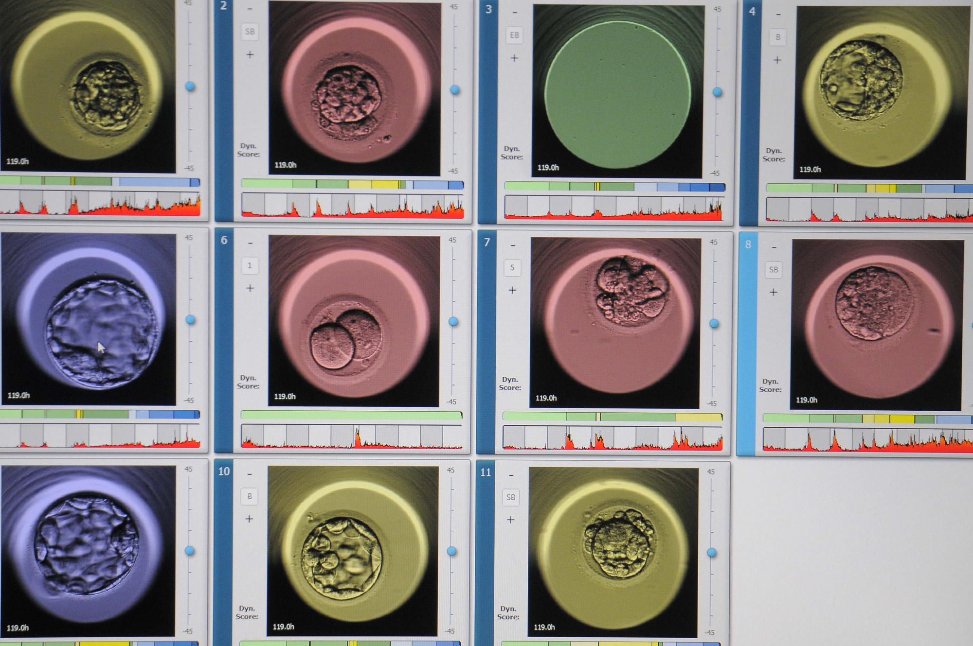 Embriones vistos con una técnica que ha permitido a especialistas de medicina reproductiva captar los primeros momentos de la vida, desde la fecundación. Integrado con una computadora y una cámara fotográfica, el incubador conocido como EmbryoScope, ha logrado que científicos del laboratorio de Fecundación in Vitro (FIV) del Instituto Valenciano de Infertilidad (IVI) sigan con detalle el desarrollo del embrión.Hasta la fecha el uso del EmbryoScope ha logrado más de 200 nacimientos y cerca de 180 embarazos en curso en Panamá.